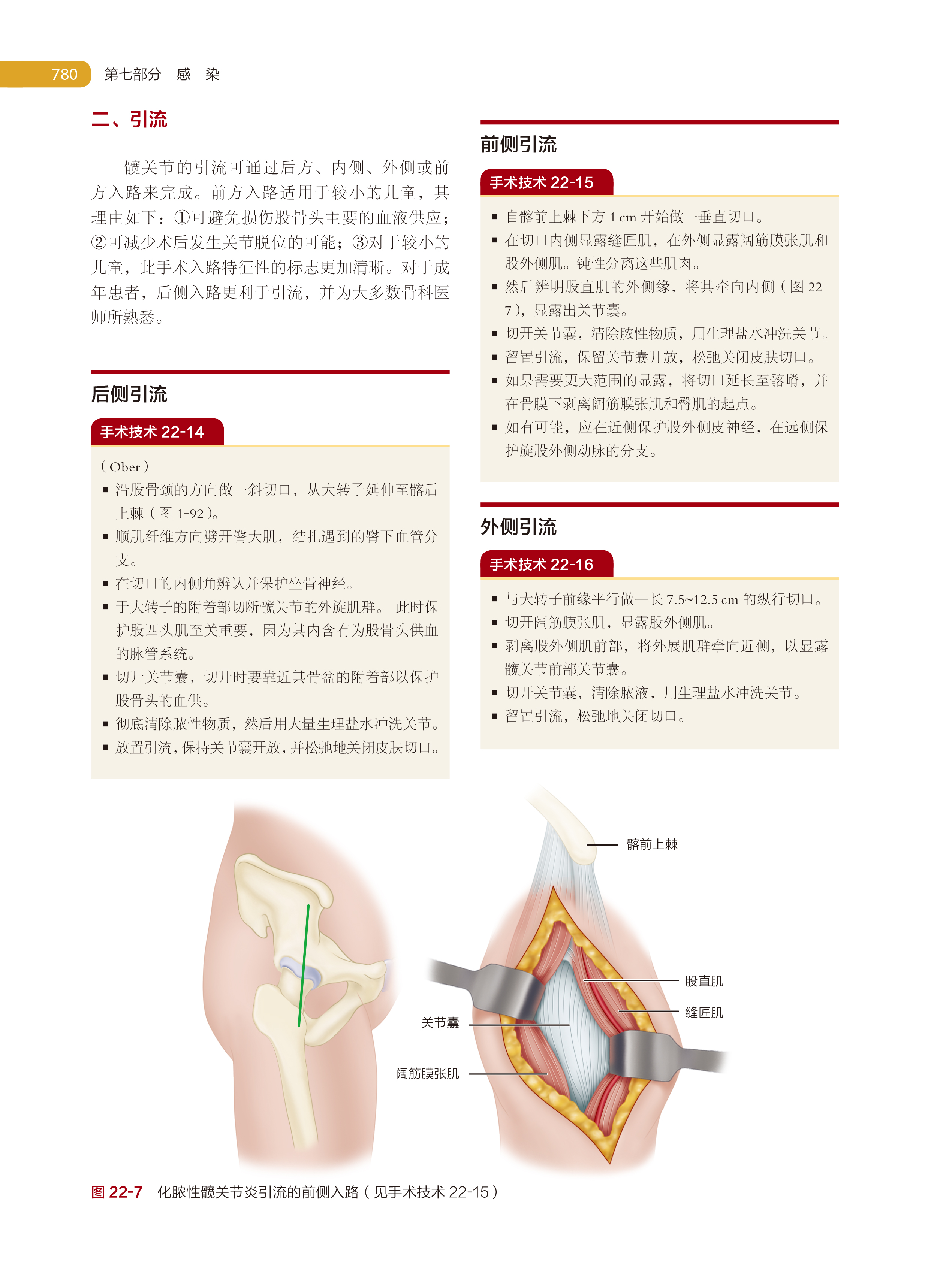 坎贝尔骨科手术学 第14版 第1-7卷 踝关节运动损伤 足部骨折与脱位 趾甲病变 唐佩福 王岩等译 凤凰新华书店旗舰店 - 图2