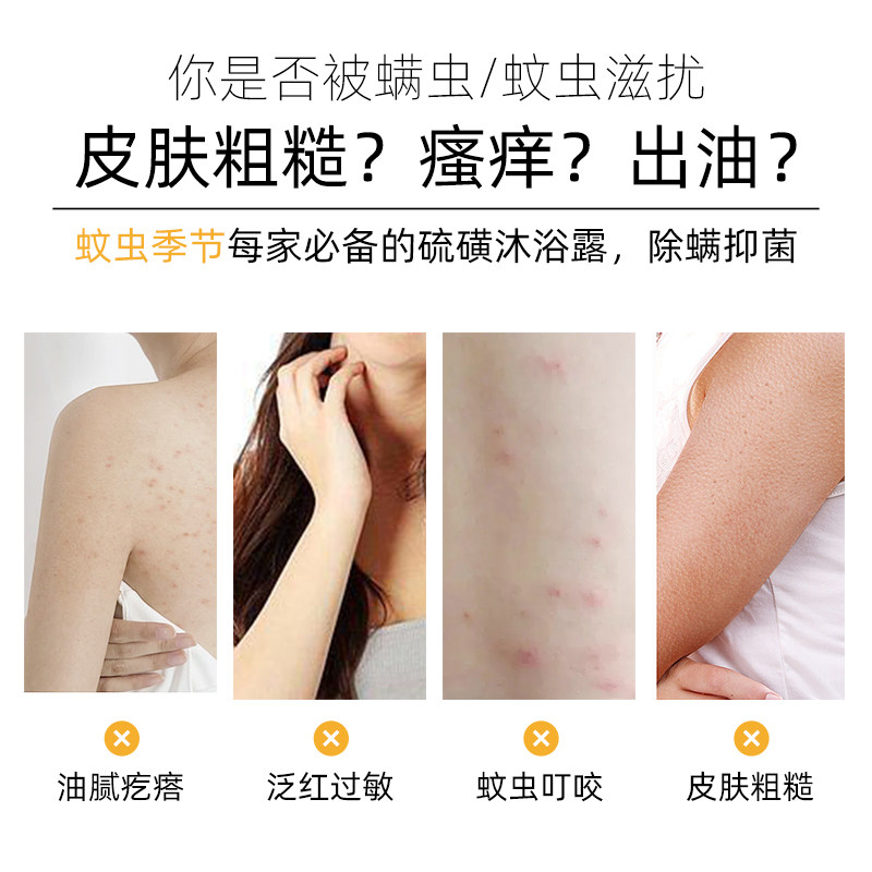 硫磺除螨后背止痒祛痘控油乳沐浴露 紫郁日化香皂