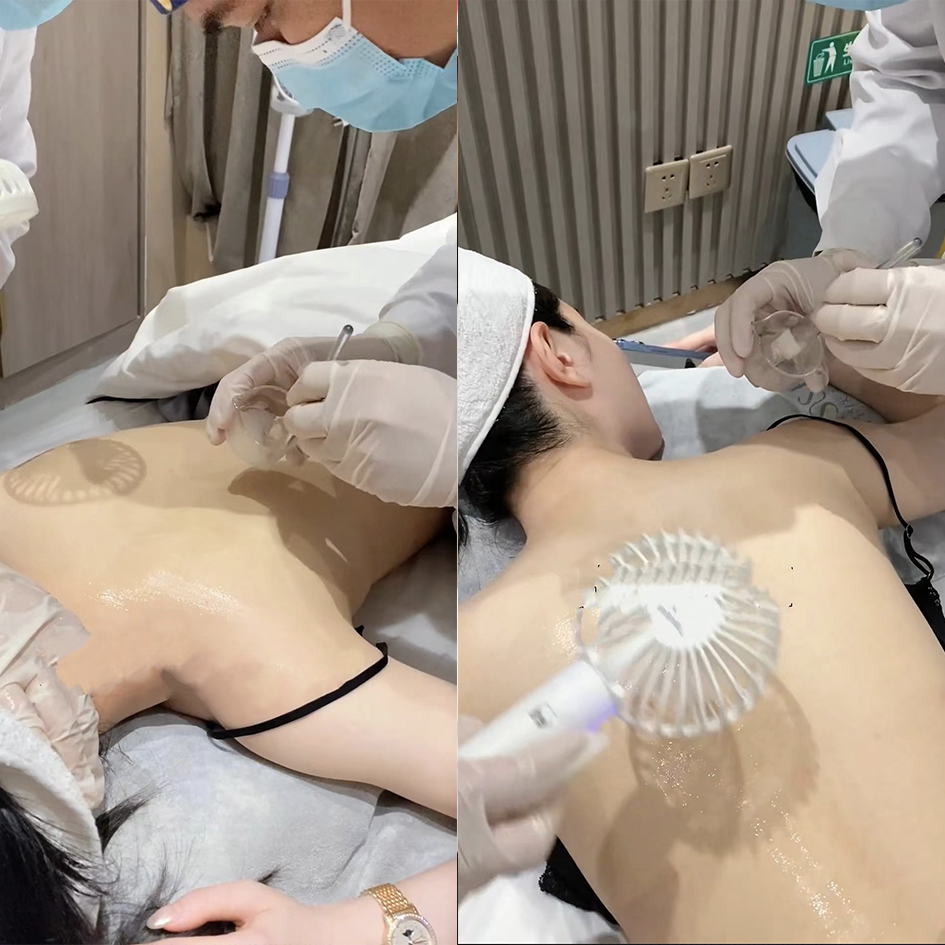 施洛可果酸50%70%70%脸身体刷酸去鸡皮肤黄褐斑雀斑美容院高浓度 - 图2