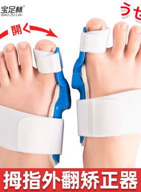宝足林拇指外翻大脚趾骨矫正器