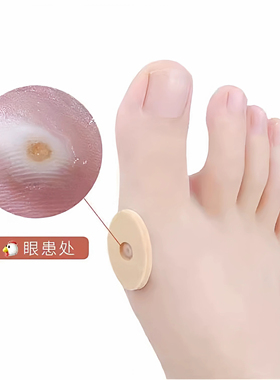 鸡眼贴防磨防挤减压缓解疼痛