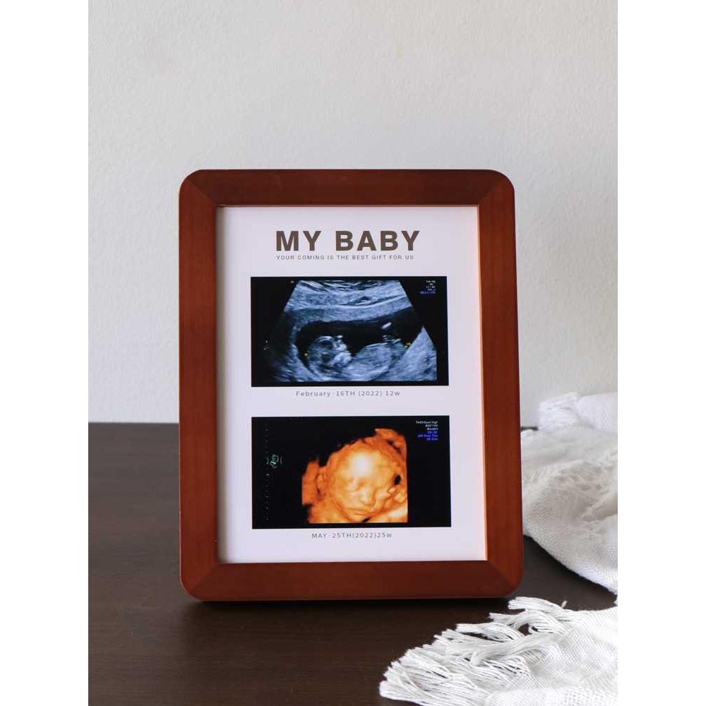 B超相框四维彩超照片宝宝三维孕妇孕检早期24周照片婴儿出生礼物