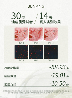 【双11抢先购】真实薰衣草纯露爽肤水湿敷补水油敏痘滋润300ml
