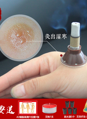 艾艾灸艾灸贴正品五年陈蕲艾贴60粒艾烛灸自灸贴艾柱爱艾贴包邮