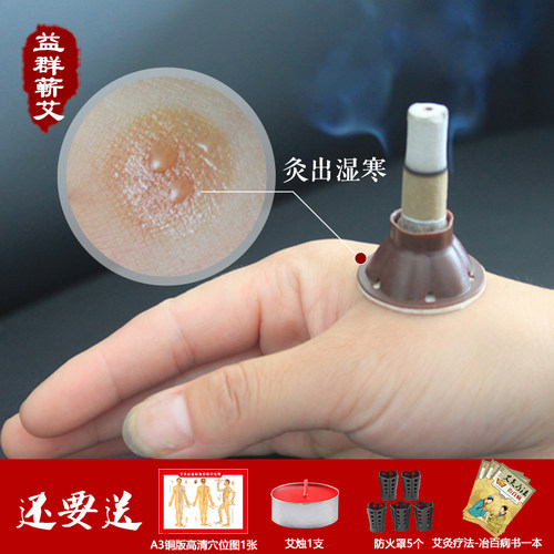 艾艾灸艾灸贴正品五年陈蕲艾贴60粒艾烛灸自灸贴艾柱爱艾贴包邮 - 图1