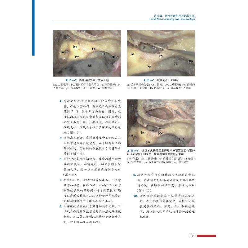 神经耳科与侧颅底手术图谱(精)(印)莫瓦尼//纳拉扬·贾亚山著张洪钿//黄传平//余永佳译神经病和精神病学 wxfx-图2