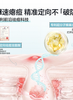 悦芙媞点痘精华祛痘快速瘪痘精华