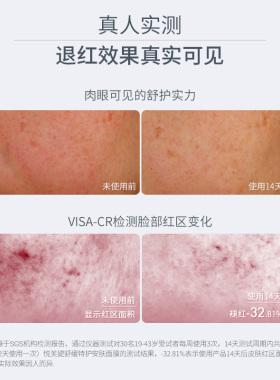 U先试用超市-悦芙媞油橄榄面膜1片保湿舒缓修护屏障维稳敏感肌