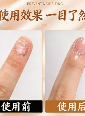 防止大人咬指甲戒吃手咬手啃手