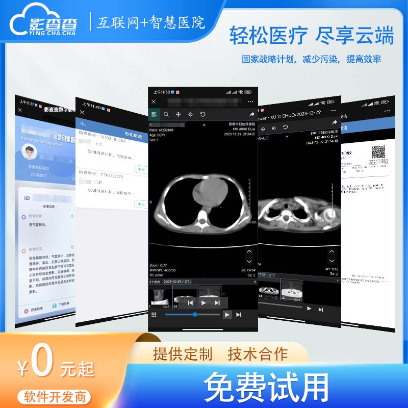 影查查云胶片云影像区域PACS远程影像报告云平台推荐医生云诊会诊 - 图2