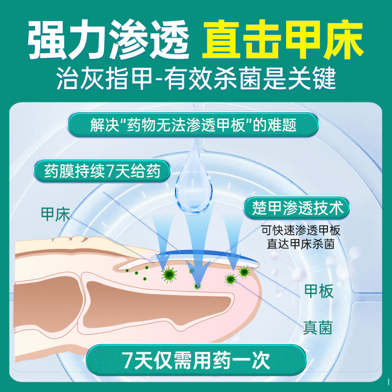 楚甲盐酸阿莫罗芬搽剂灰指甲正品专用药旗舰店脚气甲癣甲真菌病 - 图3