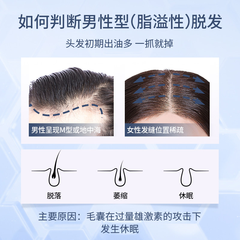 蔓迪米诺地尔酊剂生发喷雾90ml*4 阿里健康医药白发脱发