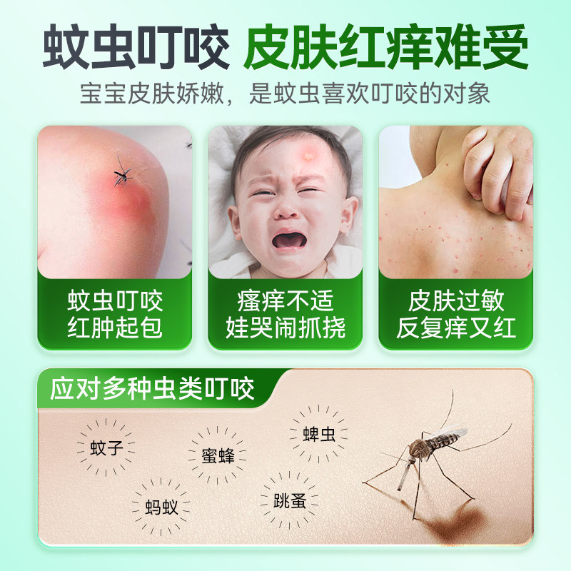 蚊虫叮咬止痒快速消肿宝宝紫草膏婴儿专用儿童蚊子咬驱蚊防蚊药膏,淘宝优惠券,粉丝福利购,淘宝优惠卷