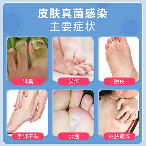 川石复方克霉唑乳膏包邮外用官方干裂愈裂止痒正品真菌药膏脚气 - 图0