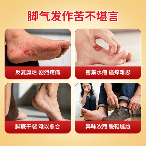 金达克宁酮康唑乳膏止痒正品真菌感染药脚气药膏官方软膏 - 图1