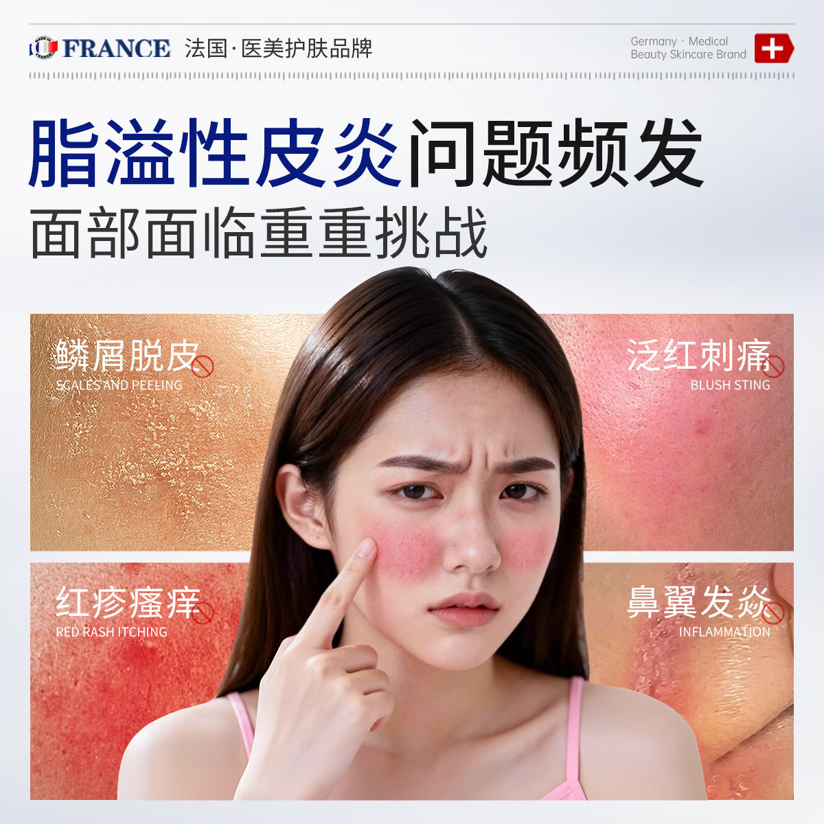 马拉色菌脂溢性皮炎面部面霜护肤品医鼻子鼻翼两侧发红泛红脸部用,淘宝优惠券,粉丝福利购,淘宝优惠卷