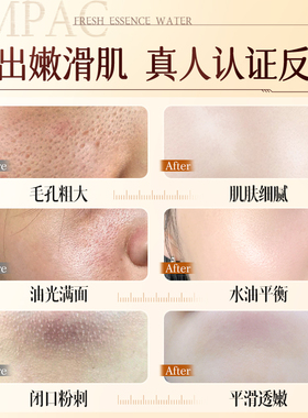 胖东來爆款*控油收缩毛孔爽肤水第I名