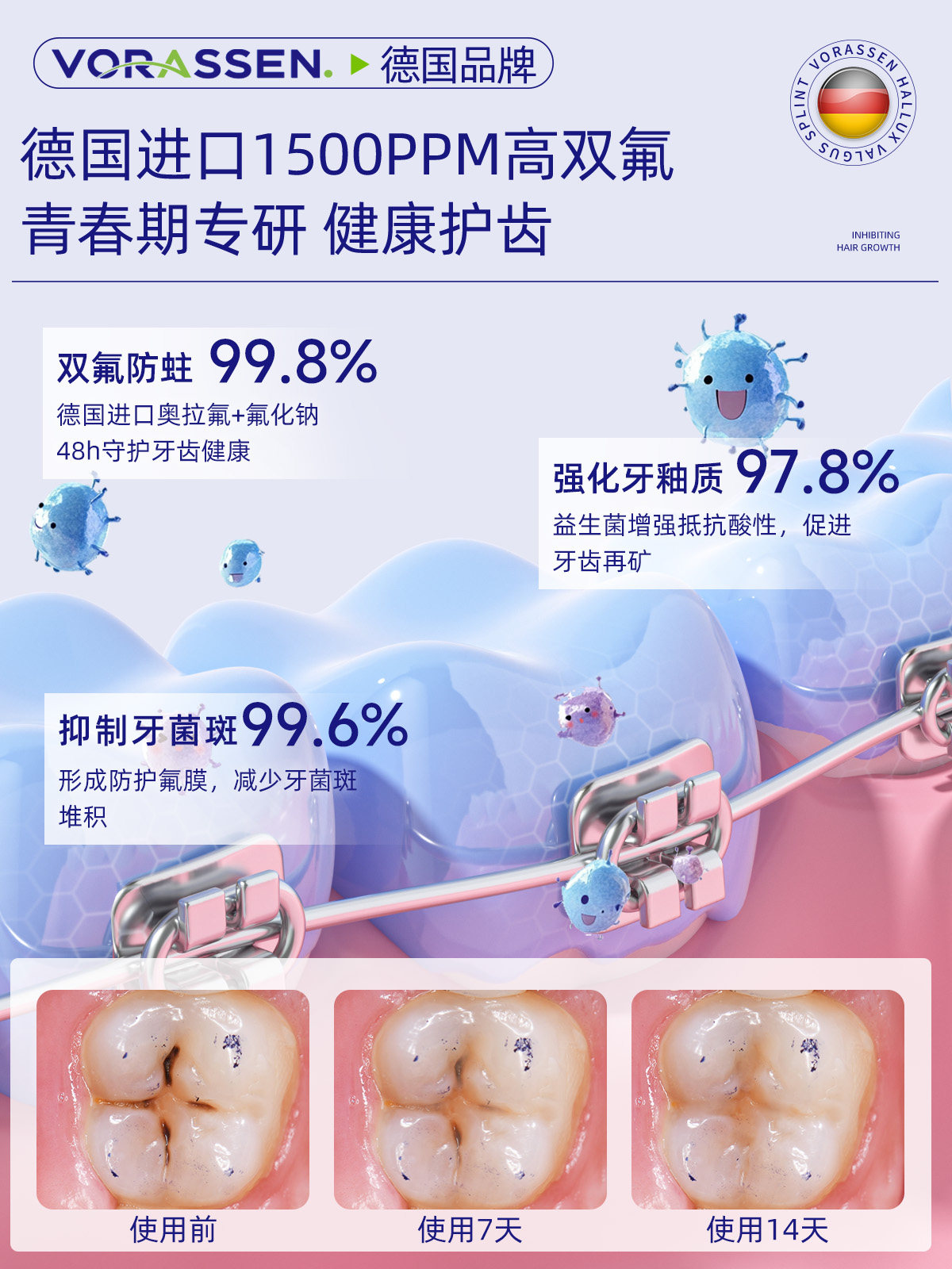 沃朗森青少年正畸专用牙膏12岁以上初高中生含氟防蛀牙龋齿修复,淘宝优惠券,粉丝福利购,淘宝优惠卷