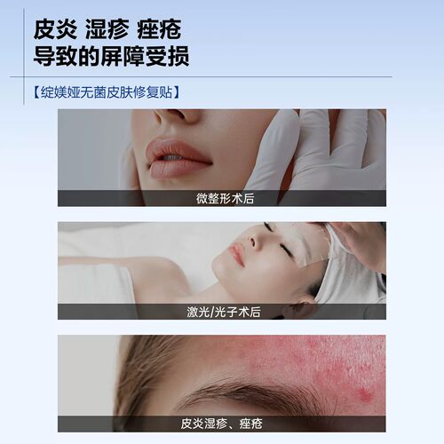 绽媄娅械准字号医用非面膜绽美娅无菌皮肤修复贴 - 图0