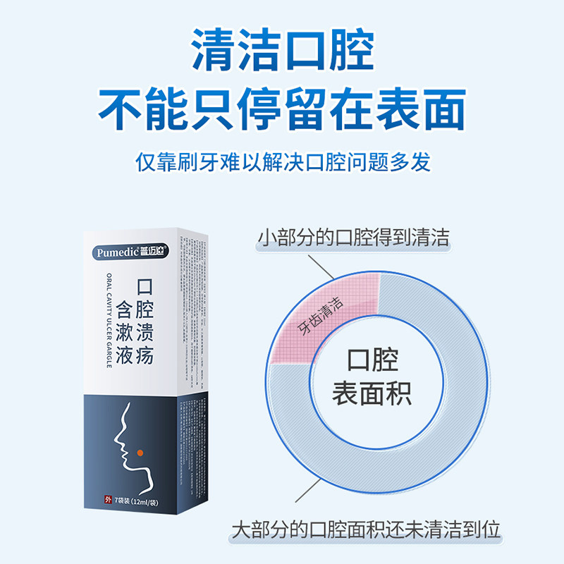 普迈迪口腔溃疡含漱液口腔炎症缓解牙龈牙箍牙套疼痛温和漱口水