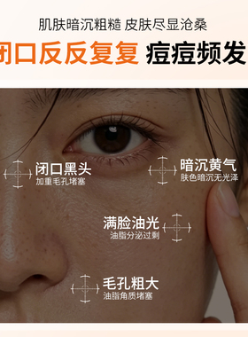甘醇酸果酸精华湿敷原液喷雾全身体美白乙醇酸类爽肤水刷子旗舰店