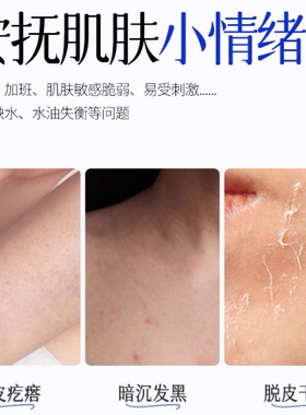【商超热销】维E尿素果酸倍护霜