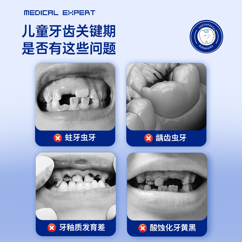 医用儿童牙膏含氟防蛀固齿0到3岁可吞咽6一12岁换牙期龋齿修复