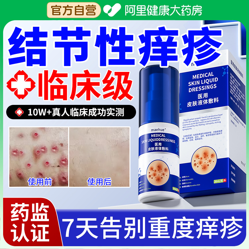 结节性痒疹特效治顽固手上长红硬疙瘩皮肤瘙痒止痒去除抑菌膏专用 - 图0