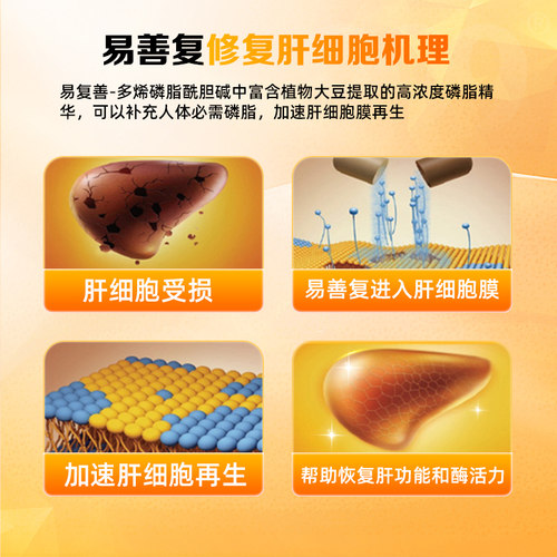 易善复多烯磷脂酰胆碱胶囊养官方旗舰店护肝排毒脂肪肝调理 - 图1