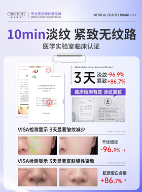 【医美院线】消除法令纹TOP