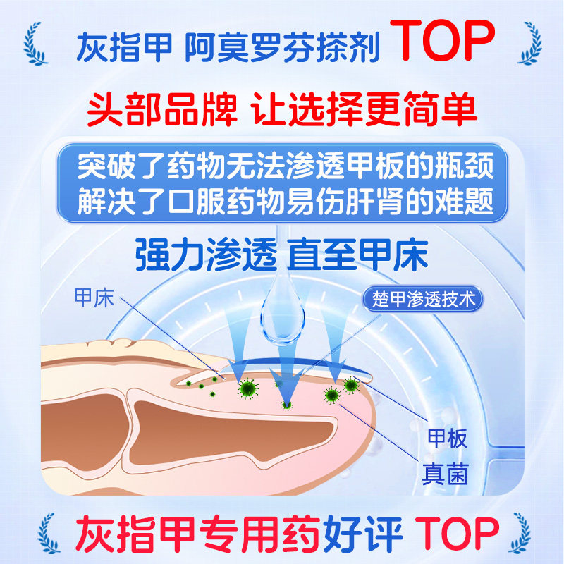 楚甲盐酸阿莫罗芬搽剂专用官方旗舰店擦剂正品灰指甲真菌脚气药房