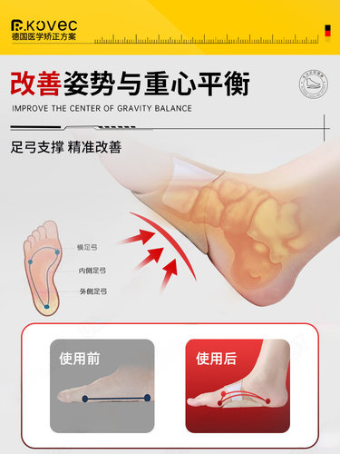 德国XO型腿平底足支撑平足矫正鞋足外翻扁平足矫正鞋垫足弓垫纠正 - 图1
