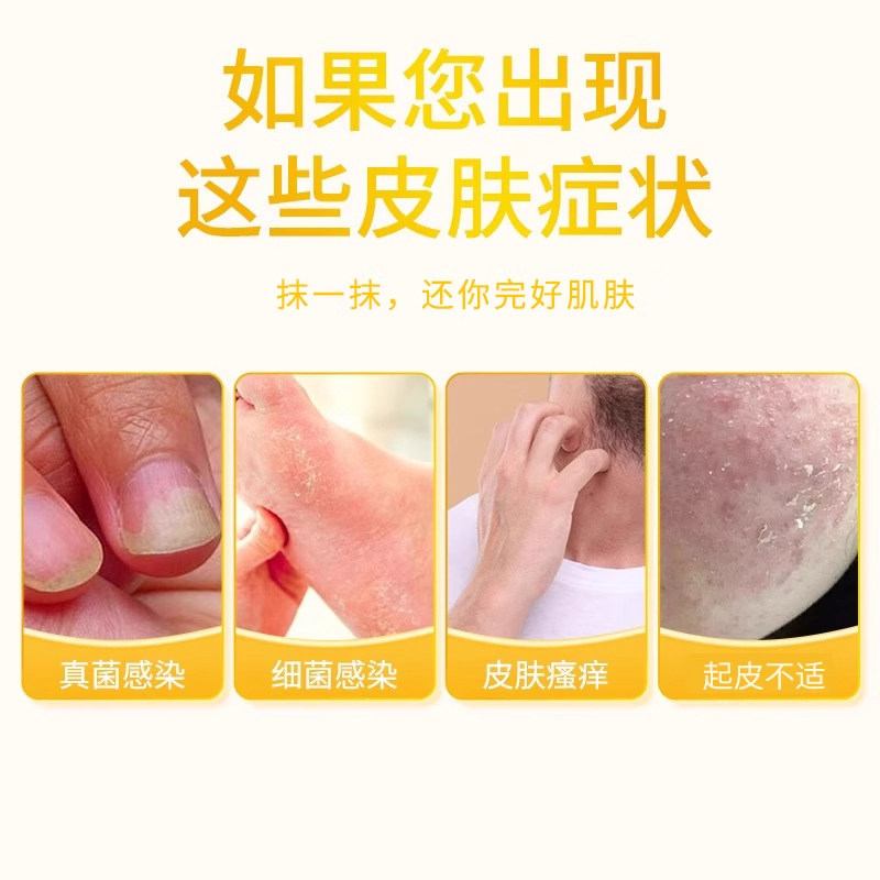 狼毒抑菌乳膏软膏止痒王外用大腿内侧男女通用正品官方旗舰店,淘宝优惠券,粉丝福利购,淘宝优惠卷