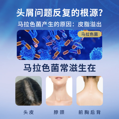 希尔生二硫化硒洗剂二硫化硒洗头水控油洗发水头皮屑专用洗发液 - 图1