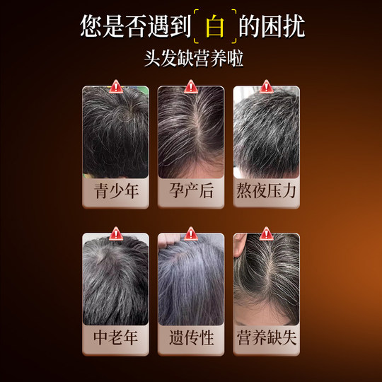 Таблетки биотина Baiyunshan b6 могут превратить белые волосы в черные и устранить первопричину.