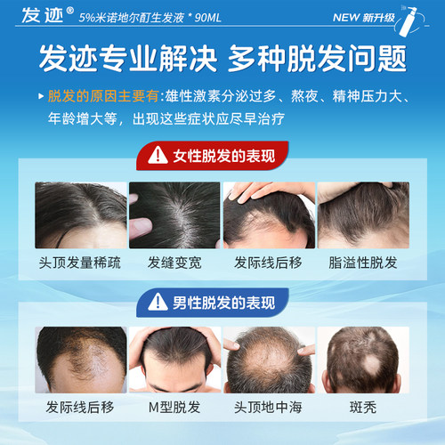 米诺地尔酊生发液官方旗舰店男士女性防脱斑秃专用正品米若米洛町 - 图1