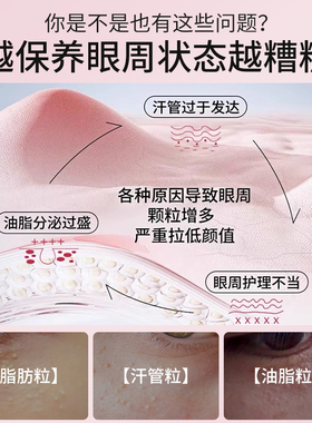脂肪粒眼周闭口去除神器非药膏眼部非针专用旗舰店油脂粒汗管非瘤