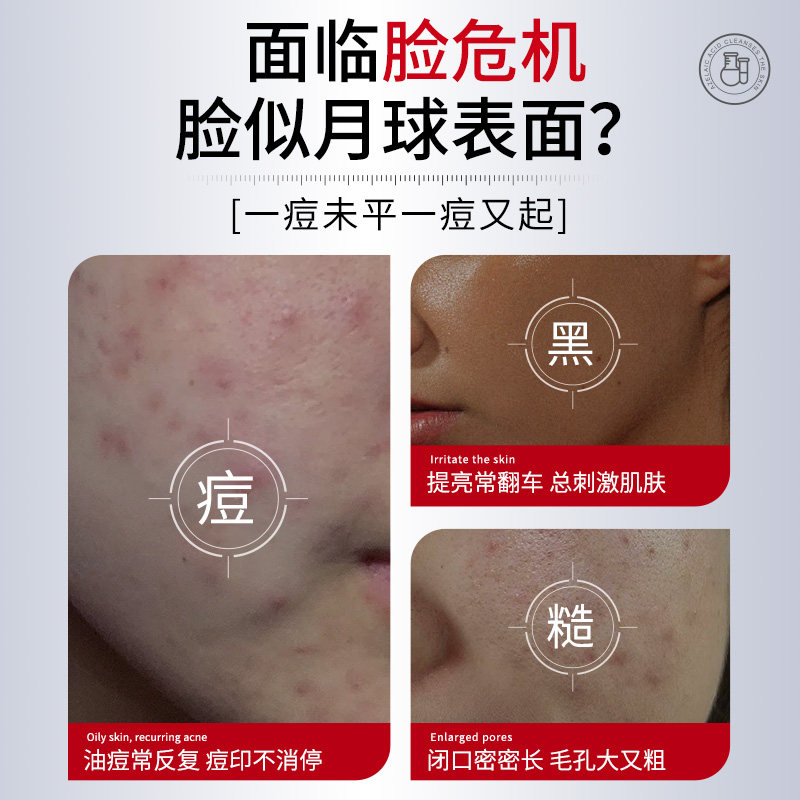 壬二酸凝胶祛痘膏祛痘印修复淡化水杨酸去黑头粉刺闭口收缩毛孔