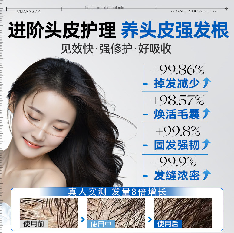头皮精华液毛囊深层清洁修护补水何首乌侧柏叶护发强韧防断发护理,淘宝优惠券,粉丝福利购,淘宝优惠卷