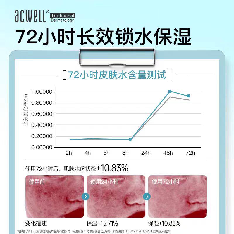 acwell艾珂薇N4面霜50ml补水滋润舒缓褪红油皮冬季清爽敏感肌急救
