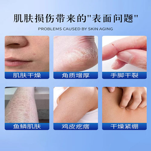 果酸ve尿素霜去鸡皮疙瘩毛囊角质身体乳维生素e乳膏正品旗舰店50g - 图0