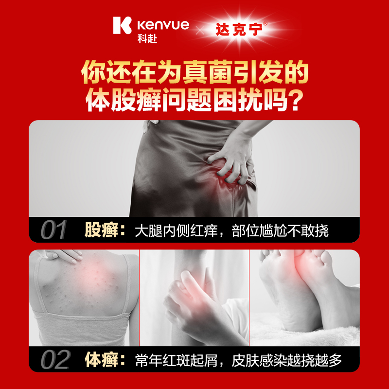 金达克宁酮康唑乳膏股癣专用药汗斑手足癣药股藓大腿内侧真菌感染 - 图0