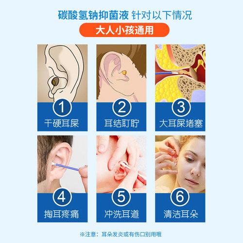 NINOO碳酸氢钠滴耳液人用耵聍软化耳屎去耳垢耳朵痒儿童成人掏耳 - 图0