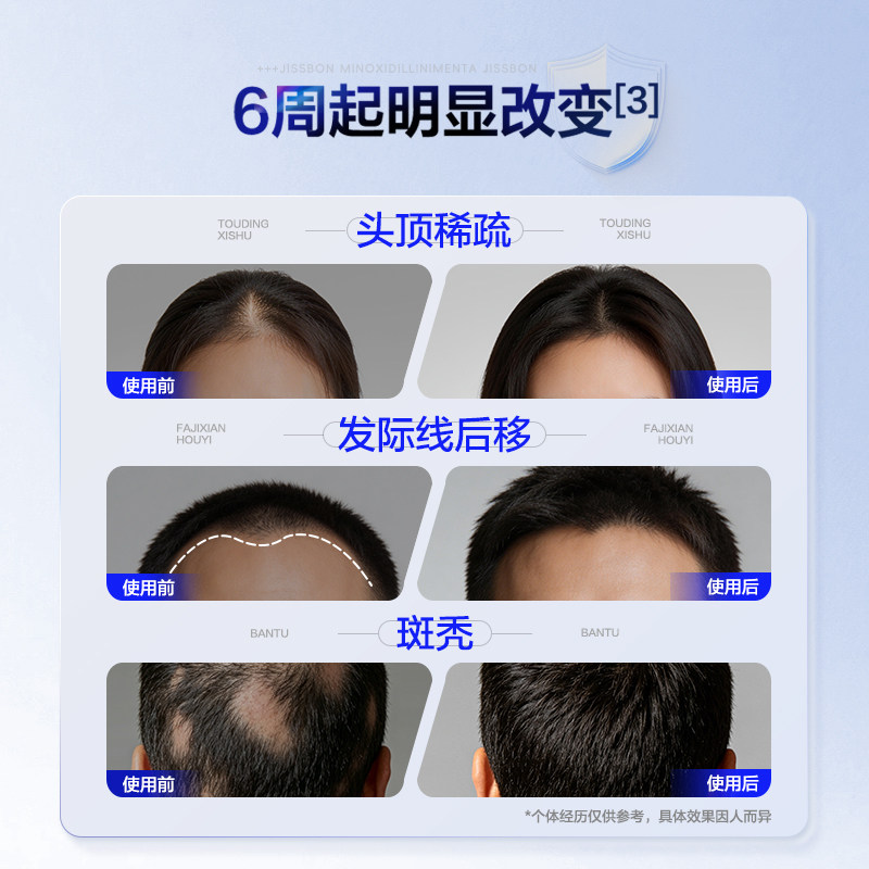 杰士邦米诺地尔搽剂男用防脱发生发液密发育正品官方旗舰店地尔酊