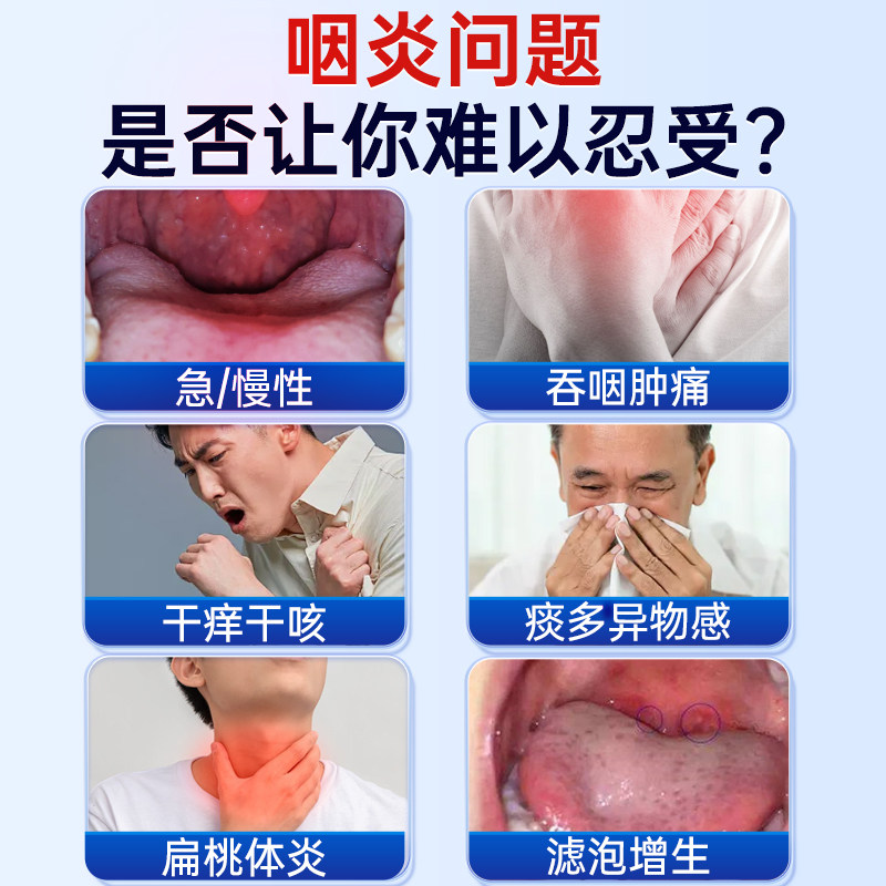 咽喉炎慢性咽炎根喉咙有痰异物感治疗咳嗽痒化痰止咳贴,淘宝优惠券,粉丝福利购,淘宝优惠卷
