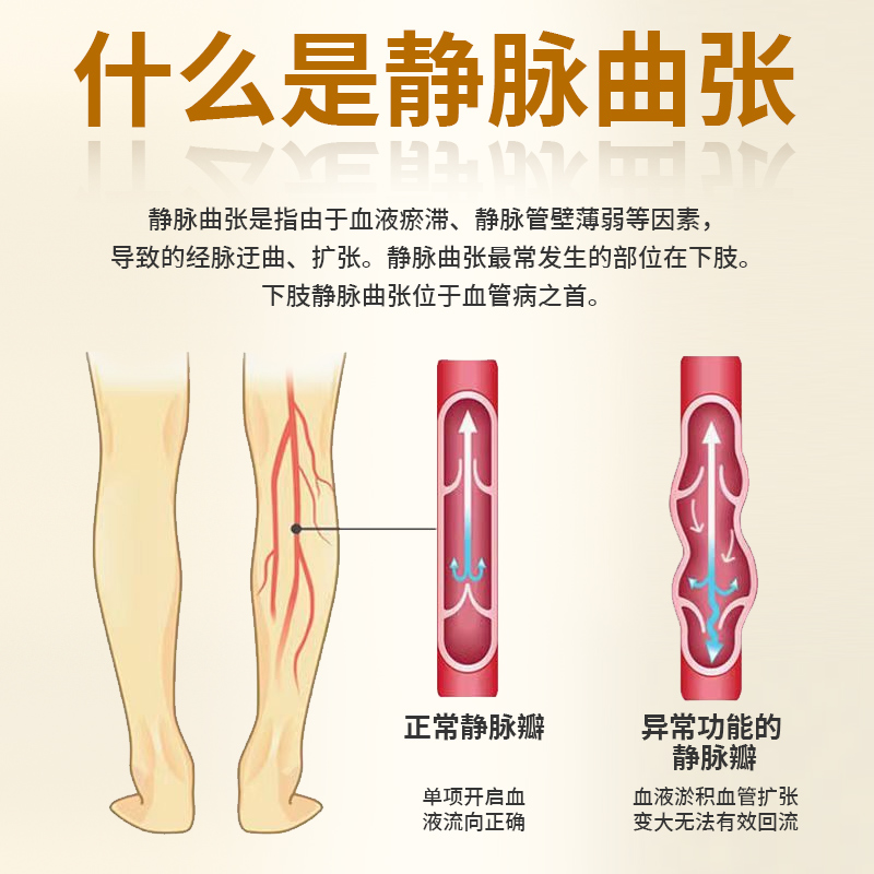 北京同仁堂静脉曲张冷敷凝胶青筋凸起精索曲张搭配药膏贴官方正品 - 图0