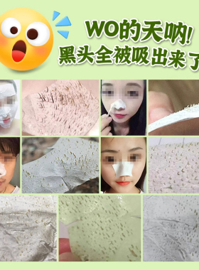 Garysoon泰国去黑头鼻贴white芦荟胶清洁毛孔套装鼻头收缩