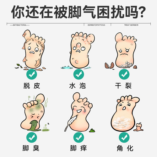 洛芙联苯苄唑溶液感染脚气真菌喷雾止痒脱皮杀菌喷雾剂药膏专用 - 图3