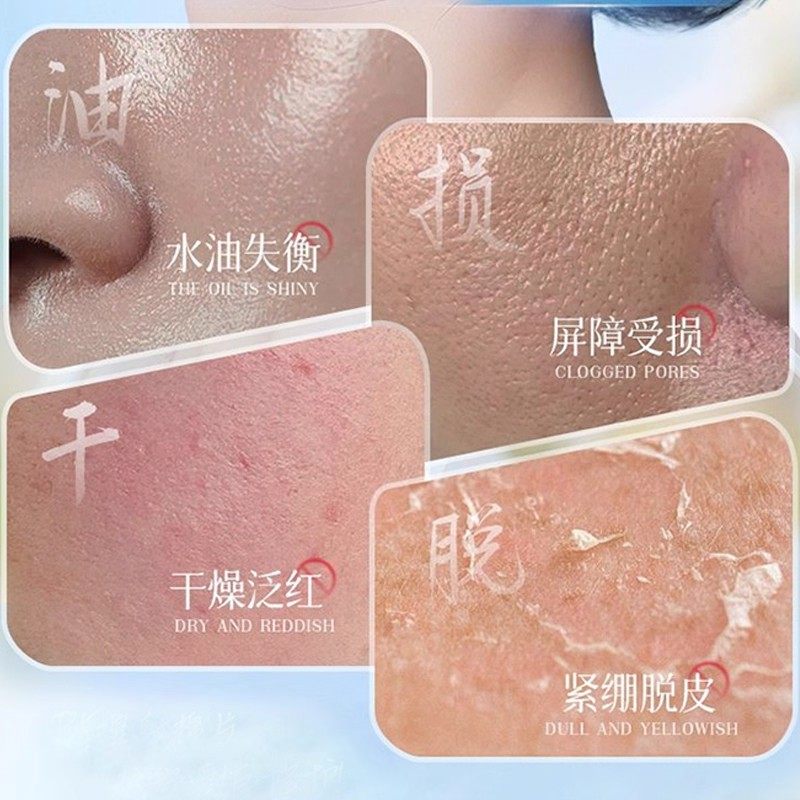 氨甲环酸湿敷棉片传明酸精华液百分之5分解去黄提亮褐斑黑色素,淘宝优惠券,粉丝福利购,淘宝优惠卷