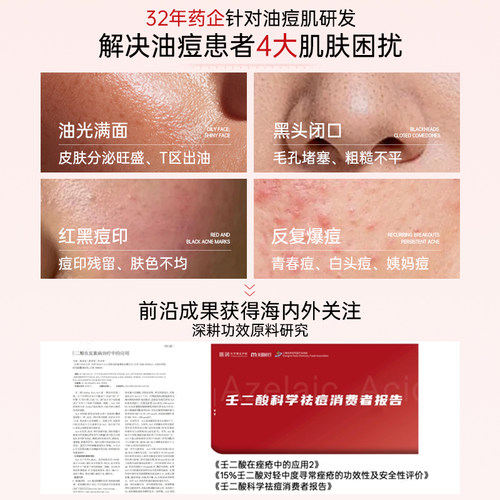 质润壬二酸祛痘膏15%壬二酸凝胶壬二酸精华祛痘印淡化痘印控油 - 图0
